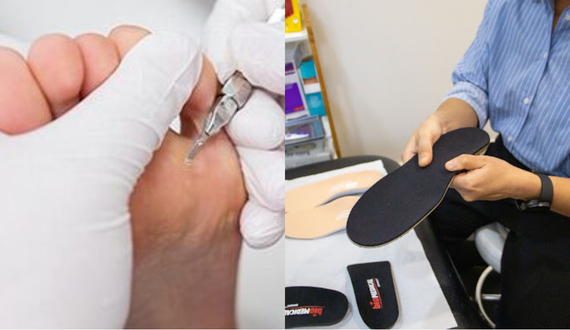 Treatment Options and Prevention Tips for Corns