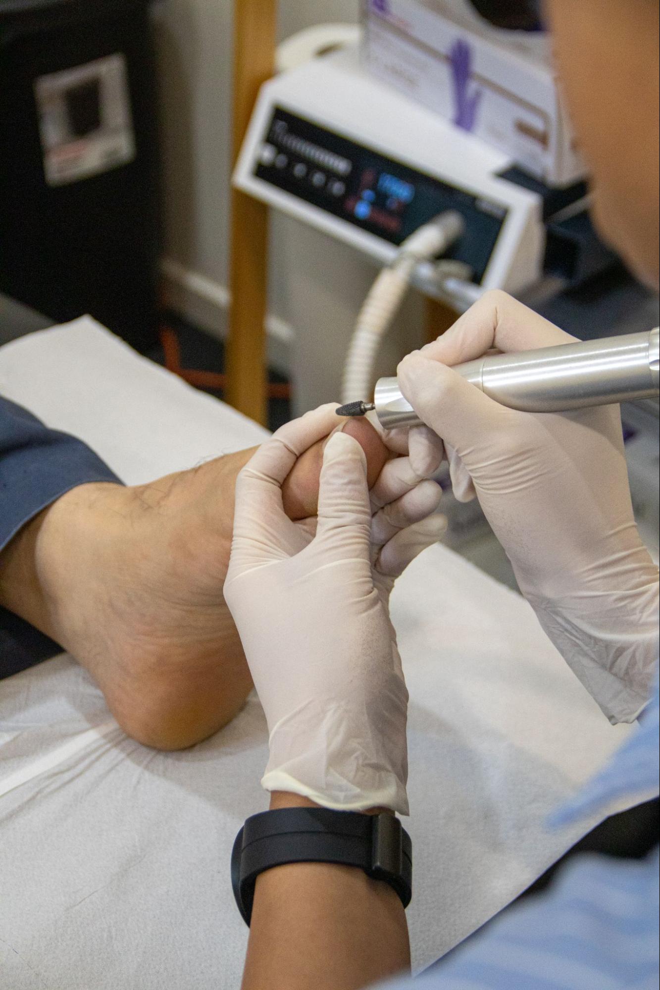 Treatment Options and Prevention Tips for Thickened Toenails