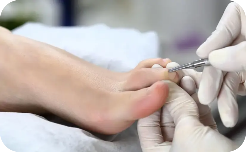 What is a Medical Pedicure (Skin and nail care)?