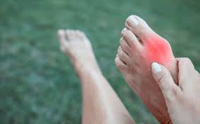 Symptoms of Bunions, Hammertoes & Toe Joint Pain