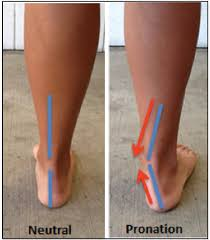 Symptoms of Flat Feet or Uneven Loading Pain