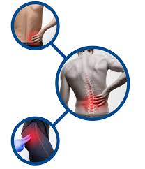 Symptoms of Gait-Linked Pain