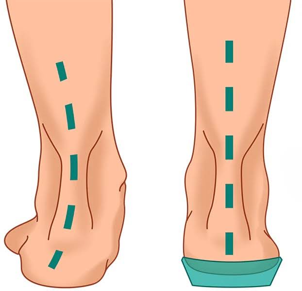 Signs & Symptoms of Alignment Concerns