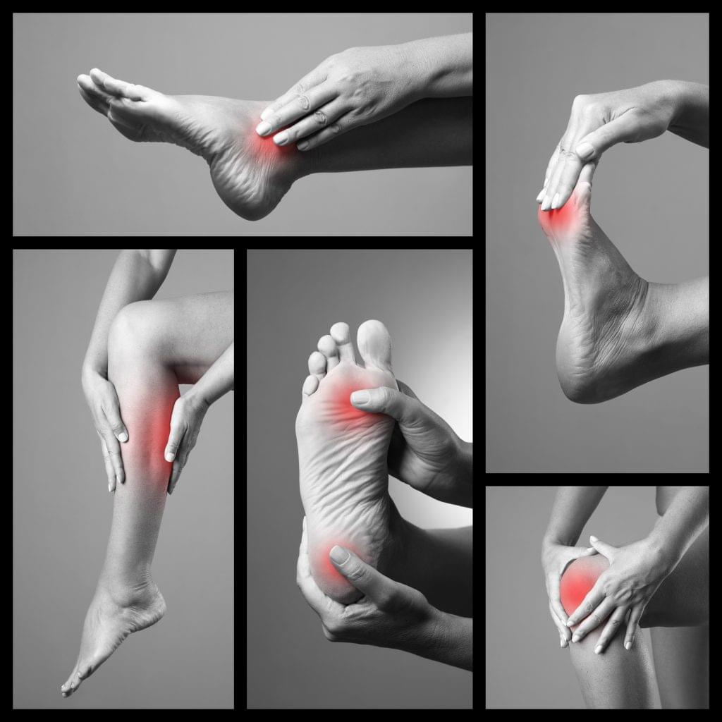 Common Foot Conditions