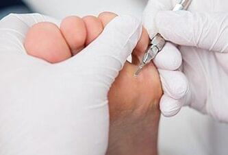Tips for foot care